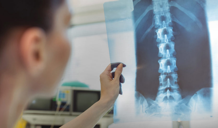 Doctor examines X-Ray of spine