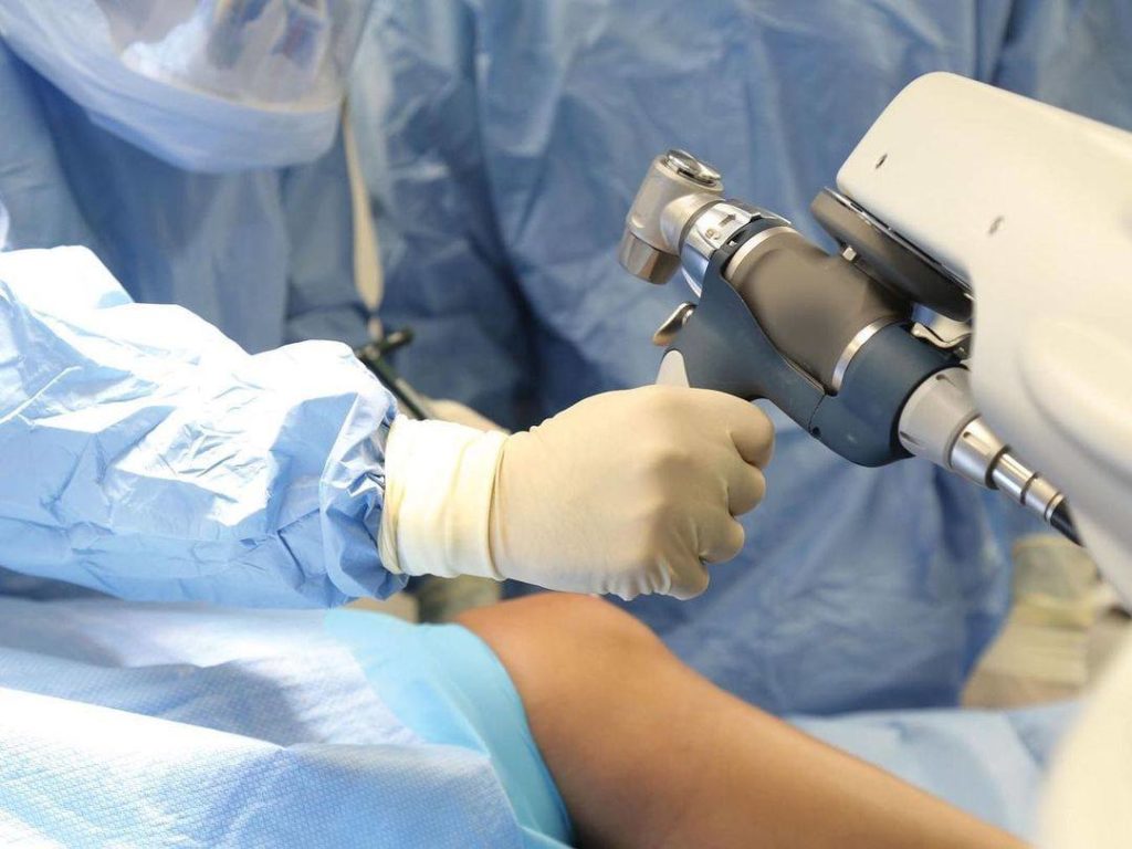 Doctor uses robotic surgery arm on patient's knee