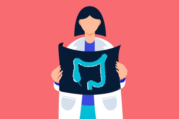 Maimonides Doctors Emphasize Importance of Regular Colon Cancer Screening as Cases in Adults Under 50 Rise