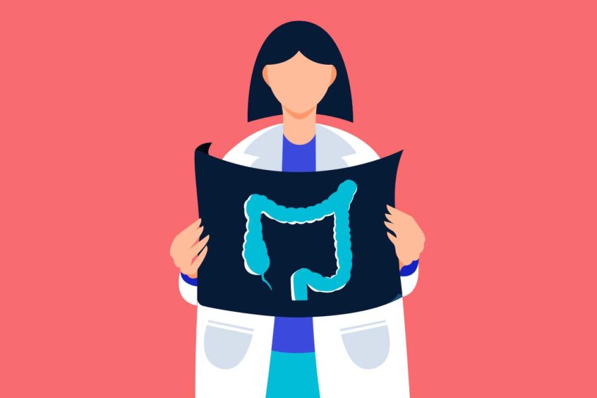 Maimonides Doctors Emphasize Importance of Regular Colon Cancer Screening as Cases in Adults Under 50 Rise