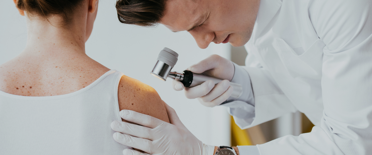 Melanoma Center